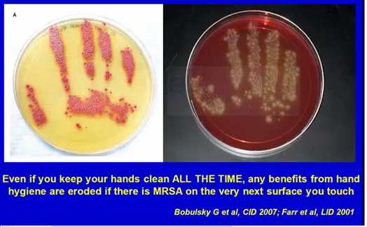 Figure 1. Microbial cultures from hand contact